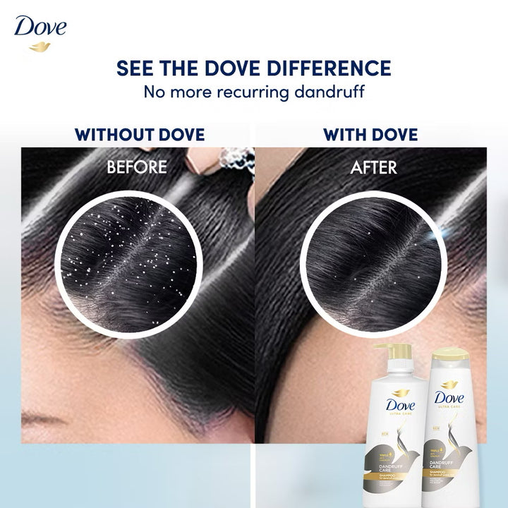 Dove Shampoo Dandruff Care 175ml