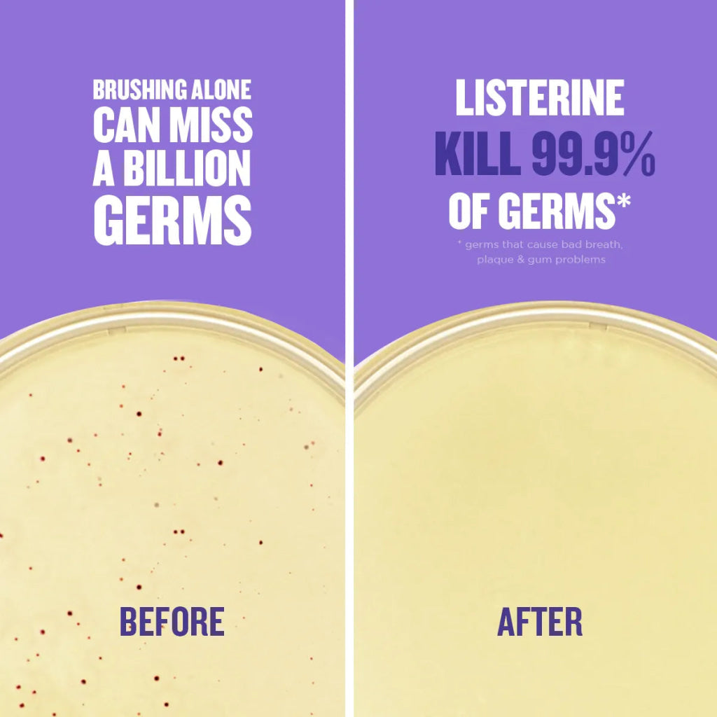 Listerine Mouth Wash Total Care Less Intense 250ml - Oral